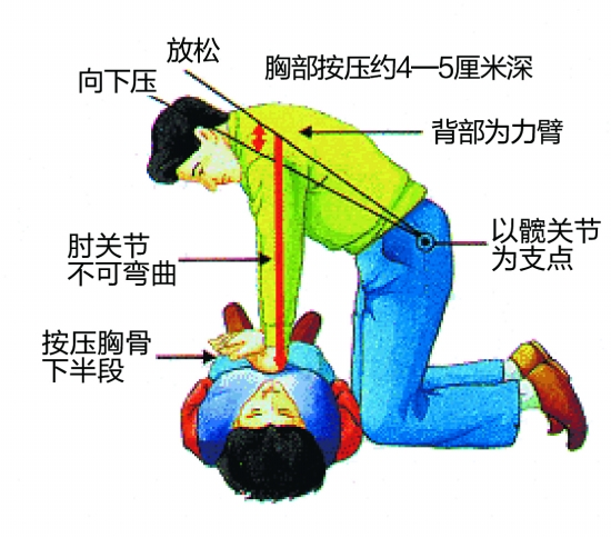 最新心肺复苏技术，生命拯救的战斗武器